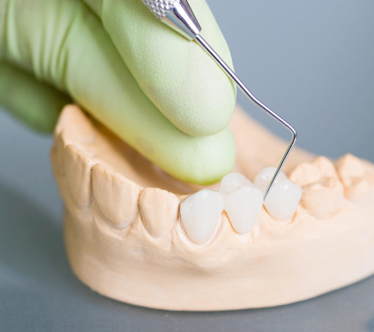 Hand of dentist holding dental gypsum models