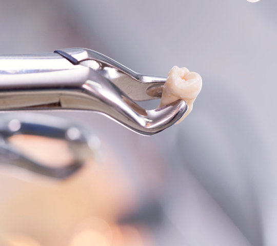 Dental equipment holding an extracted tooth