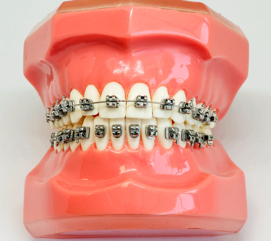 Artificial model of human jaw with wire